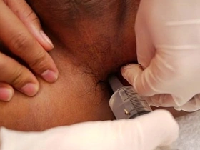 Thai doctor examines horny patient